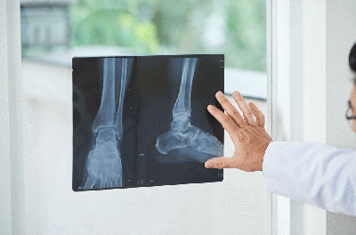 Provider holding an xray image of a foot up to a window